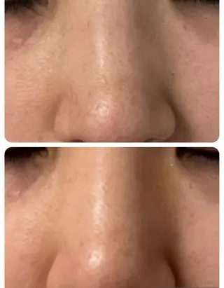 愛維美水光美肌専門店所属・愛維美水光美肌専門店 メンズレディースokのエステ・リラクイメージ