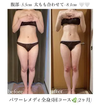 《本気痩せ×疲労改善 》  BILOOPのエステ・リラクイメージ