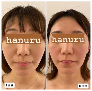 美容整体・小顔矯正 hanuruのエステ・リラクイメージ