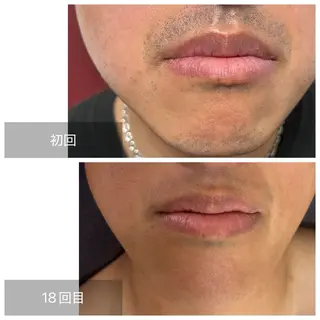 メンズ エマニエル USAのエステ・リラクイメージ