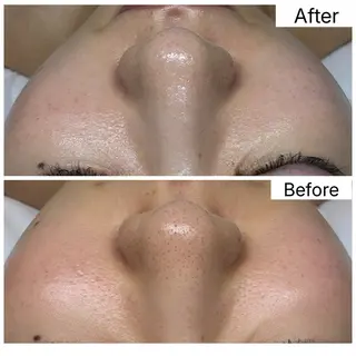 Hémireve Shirokane所属・トロイアルケ🩵 美眉EMIの眉毛・アイブロウイメージ