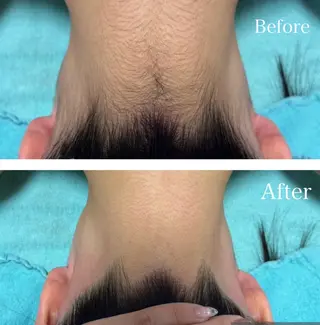 都度払い脱毛サロン 【横浜東口】のエステ・リラクイメージ