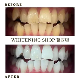 ホワイトニング ショップ葛西店のその他イメージ