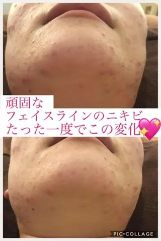 ミディアム カラー パーマ ヘアアレンジ メンズ キッズ ネイル マツエク・マツパ ニキビ・肌質改善専門 ♡人生が変わるサロンのエステ・リラクイメージ