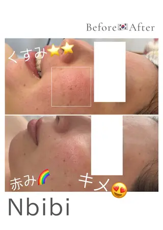 韓国🇰🇷価格 サロン_Nbibiの眉毛・アイブロウイメージ