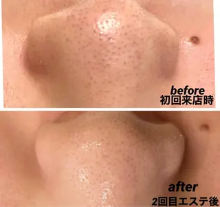 小林 玲菜のエステ・リラクイメージ