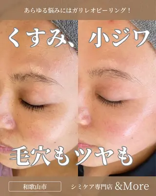 シミケア専門店 &Moreのエステ・リラクイメージ