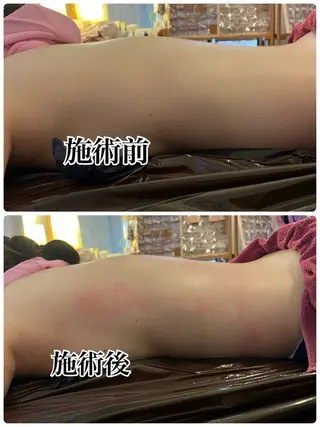 ❤︎MN❤︎ モンのエステ・リラクイメージ