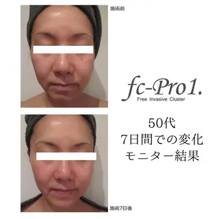 シルフィア｜ 小顔／深層マッサージのエステ・リラクイメージ