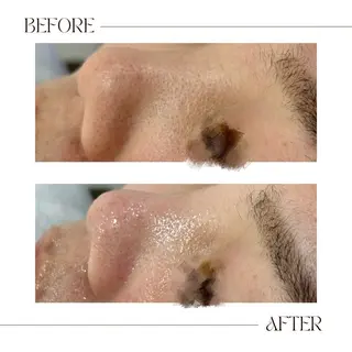 AY'S所属・倉敷/玉島/20代 からの大人毛穴洗浄のエステ・リラクイメージ