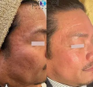 メンズ LOUISE. ／肌質・頭皮のエステ・リラクイメージ