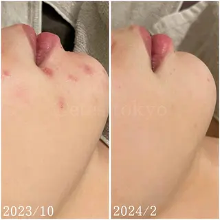 etes.tokyo 中目黒のエステ・リラクイメージ