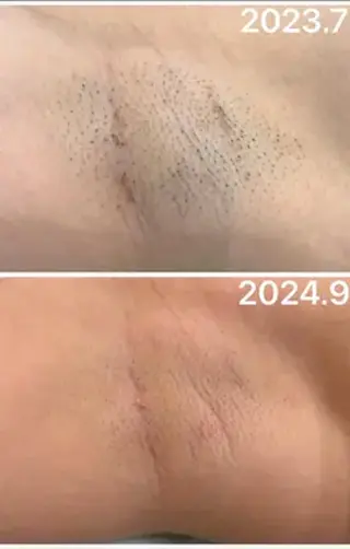 脱毛＆フェイシャル MIEUX心斎橋店のその他イメージ