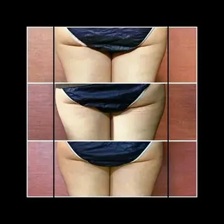 Nako  ﾅｺのエステ・リラクイメージ