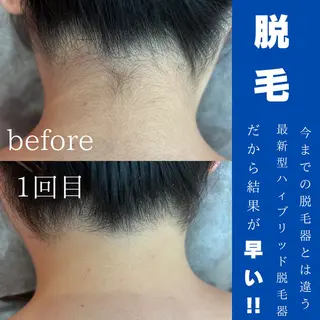 WAX・肌質改善・毛 穴洗浄/林愛真のエステ・リラクイメージ