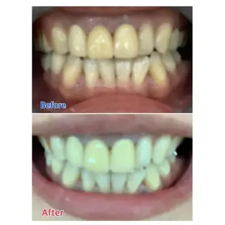 M渋谷 ホワイトニングのエステ・リラクイメージ