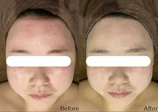 Dahlia痩身脱毛 フェイシャル 中村のエステ・リラクイメージ