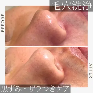 《美肌･小顔》美容鍼 ＆マッサージ＊MEIのエステ・リラクイメージ