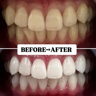 メンズ キッズ 歯科提携サロン ホワイトニング豊中のその他イメージ