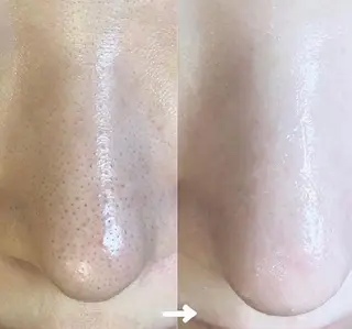 メンズ beauty salonnのエステ・リラクイメージ