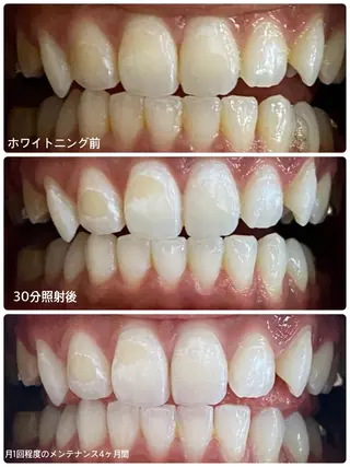 ホワイトニングサロン ラウレアのその他イメージ