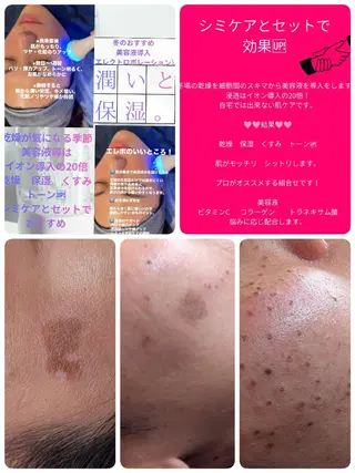 SPOT.com  シミケア専門店のエステ・リラクイメージ