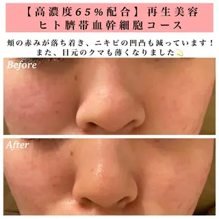 Bellesthe (ベルエステ)のエステ・リラクイメージ