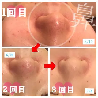 セミロング カラー パーマ ヘアアレンジ メンズ キッズ ネイル マツエク・マツパ 金の糸脱毛 産毛ケア専門のエステ・リラクイメージ