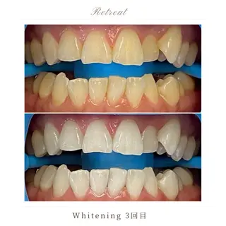 歯科医院提携 Retreatのエステ・リラクイメージ