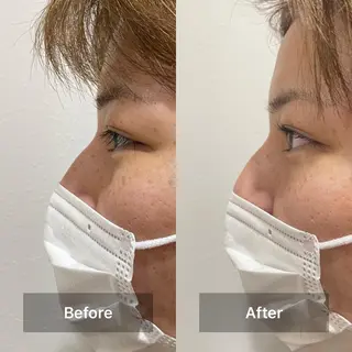 マツエク・マツパ 竹廣 春奈のヘアスタイル