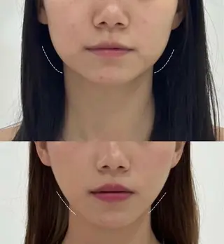 愛維美水光美肌専門店所属・愛維美水光美肌専門店 メンズレディースokのエステ・リラクイメージ