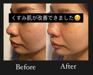 よもぎ蒸し専門店 Artemisiaのエステ・リラクイメージ