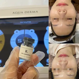 美肌・小顔専門🪄 看護師施術/松﨑のエステ・リラクイメージ