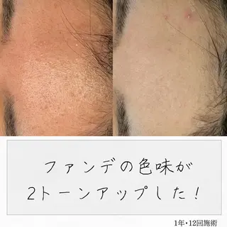 ニキビ経験者が施術 する専門サロン🌻のエステ・リラクイメージ