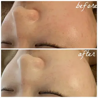 メンズ メナード岐阜茜部 杉浦のエステ・リラクイメージ