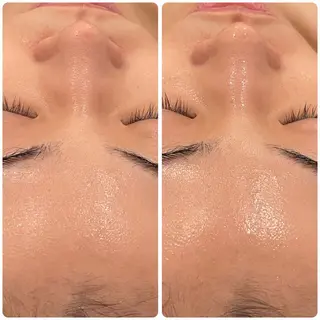 立体小顔×艶肌×美ボ ディ似合わせ施術 岡のエステ・リラクイメージ