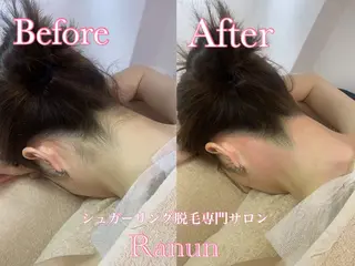 マツエク・マツパ シュガーリング脱毛 専門店Ranunのエステ・リラクイメージ