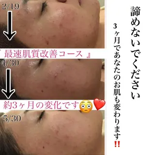 ミディアム カラー パーマ ヘアアレンジ メンズ キッズ ネイル マツエク・マツパ ニキビ・肌質改善専門 ♡人生が変わるサロンのエステ・リラクイメージ