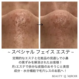 ビューティー ミロワールのエステ・リラクイメージ