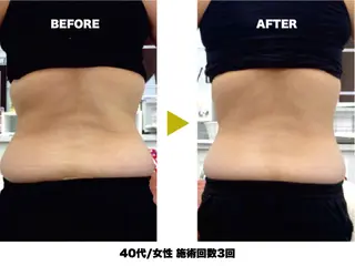 【痩身/ダイエット】 オーバイワン横浜🍓のエステ・リラクイメージ