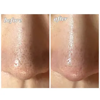 結果重視｜毛穴エステ ｜友綱理恵のエステ・リラクイメージ