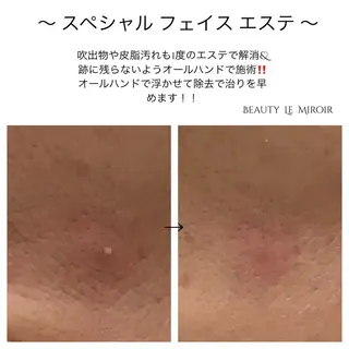 ビューティー ミロワールのエステ・リラクイメージ