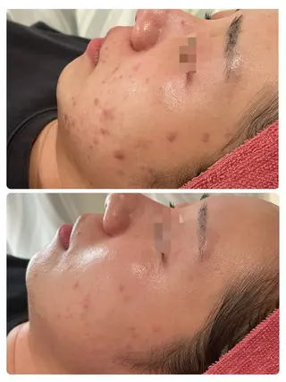 Dione 立川店のエステ・リラクイメージ