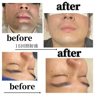 ViSchoen 西川のエステ・リラクイメージ