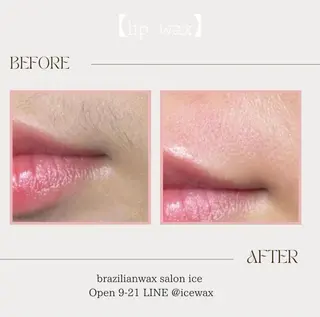 マツエク・マツパ アイブロウ ワックス脱毛専門店 ICE北千住のエステ・リラクイメージ