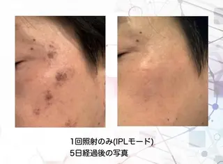 Felice🌸脱毛 ・光フェイシャルのエステ・リラクイメージ