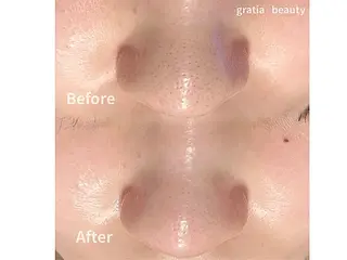 gratia eyelash･nail･beauty所属・gratia salonのエステ・リラクイメージ