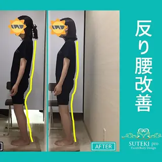 姿勢・骨盤/小顔矯正 痩身ダイエット 横田のエステ・リラクイメージ