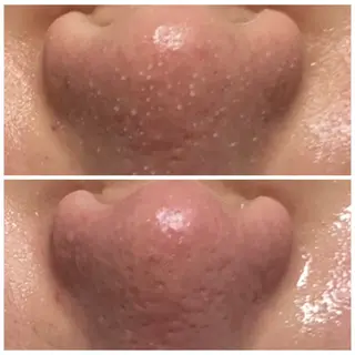 Linoa（リノア） エステ&リラクのエステ・リラクイメージ