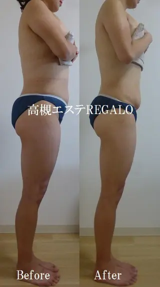 REGALO所属・矢野 さやかのエステ・リラクイメージ